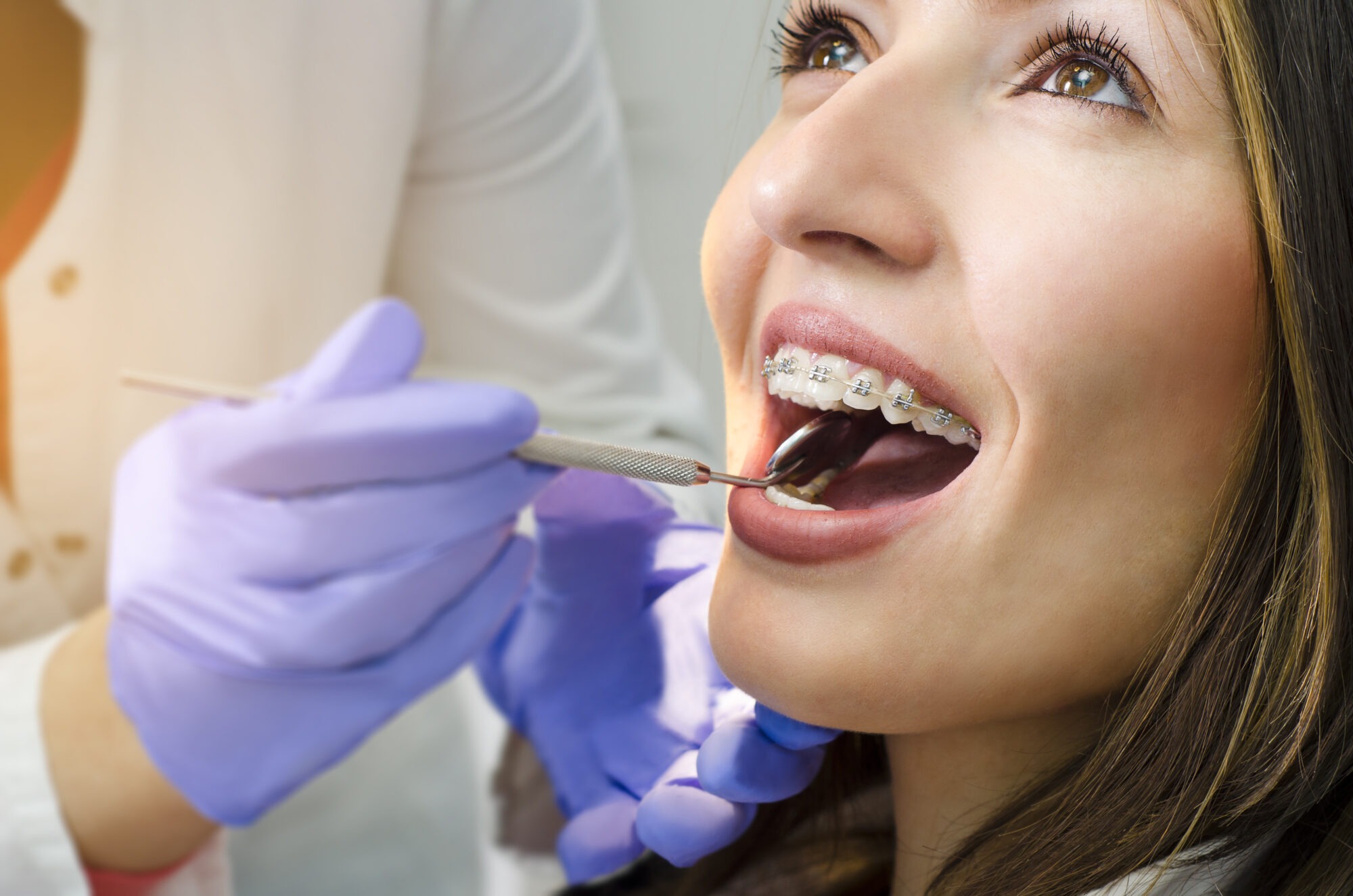 Which Orthodontic Treatment is Right For Me?